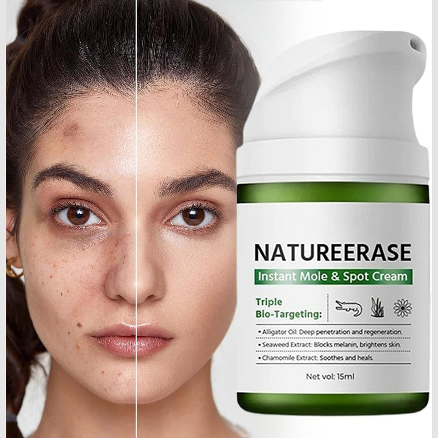 NatureErase Instant Mole& Spot Cream Fades Moles, Spots & Discoloration at the Source
