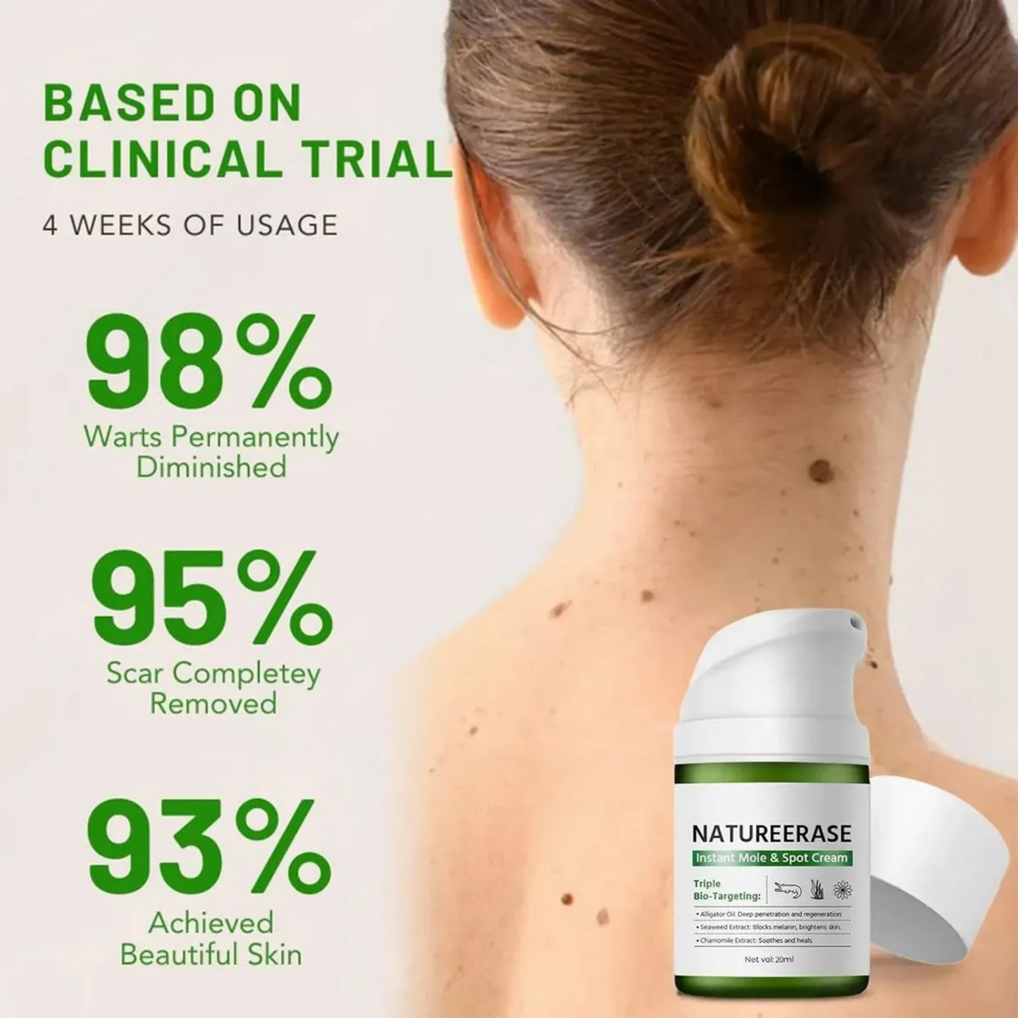 NatureErase Instant Mole& Spot Cream Fades Moles, Spots & Discoloration at the Source